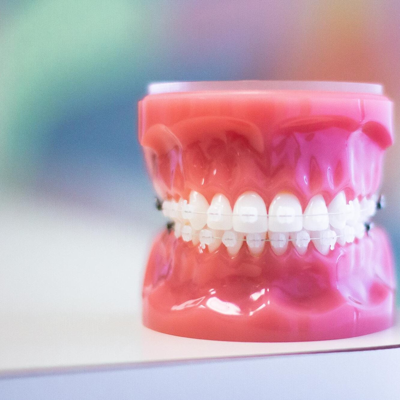 Clear Braces
