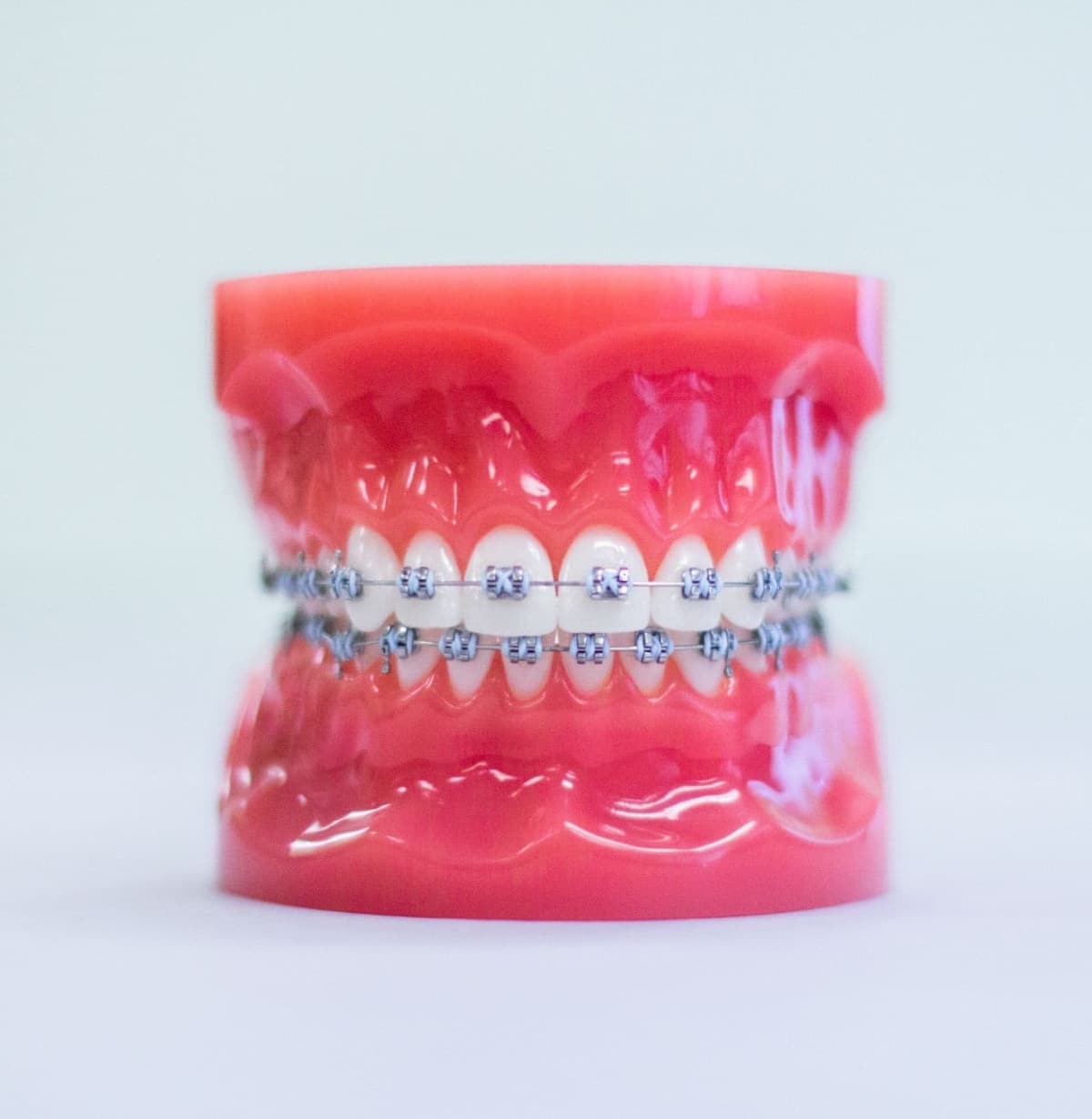 treatment-metal-braces.jpg